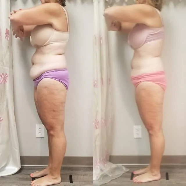 Female client body composition before and after, side profile showing reduced midsection
